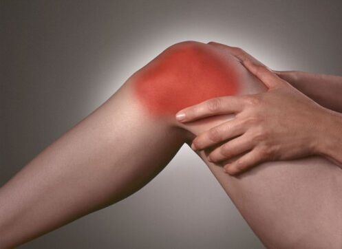 Arthritis of the knee joint