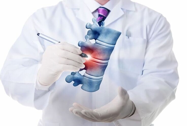 lesions of the spine due to thoracic osteochondrosis